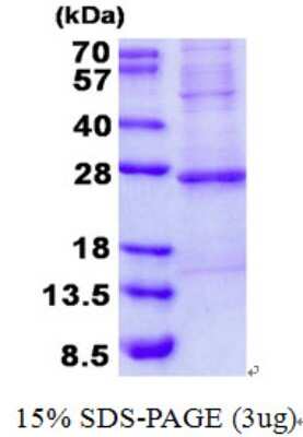 SDS-PAGE: Recombinant Human Troponin I type 2 (fast skeletal) His Protein [NBP2-22893]