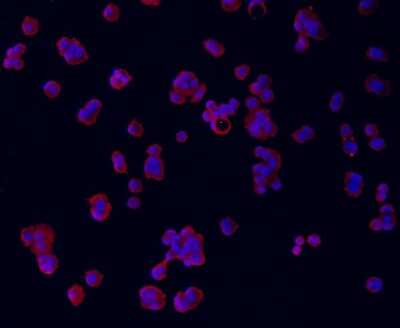 Immunocytochemistry/ Immunofluorescence: Troponin T Type 2 (cardiac) Antibody (5-C7) [NBP2-67211]