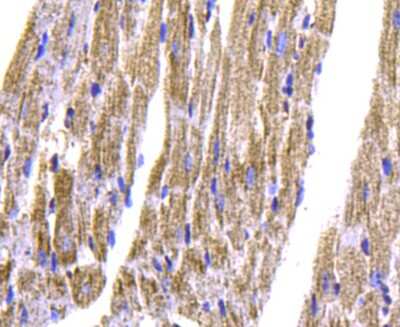 Immunohistochemistry-Paraffin: Troponin T Type 2 (cardiac) Antibody (5-C7) [NBP2-67211]