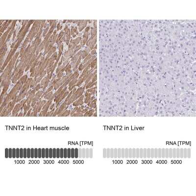 Immunohistochemistry-Paraffin: Troponin T Type 2 (cardiac) Antibody [NBP1-88069]