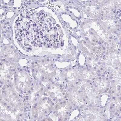Immunohistochemistry-Paraffin: Troponin T Type 2 (cardiac) Antibody [NBP1-88069]