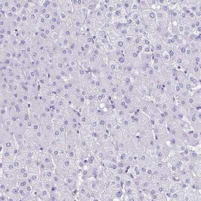 Immunohistochemistry-Paraffin: Troponin T Type 2 (cardiac) Antibody [NBP1-88069]