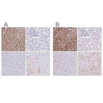 Immunohistochemistry-Paraffin: Troponin T Type 2 (cardiac) Antibody [NBP1-88069]