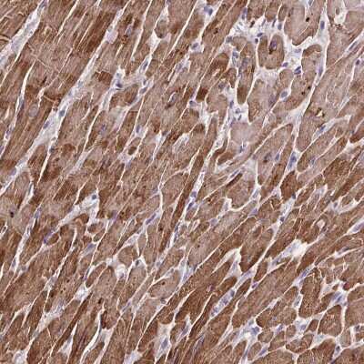 Immunohistochemistry-Paraffin: Troponin T Type 2 (cardiac) Antibody [NBP1-88070]