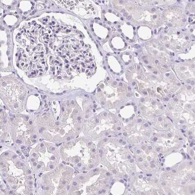 Immunohistochemistry-Paraffin: Troponin T Type 2 (cardiac) Antibody [NBP1-88070]