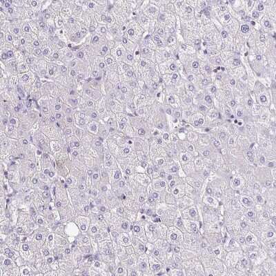Immunohistochemistry-Paraffin: Troponin T Type 2 (cardiac) Antibody [NBP1-88070]