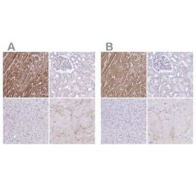 Immunohistochemistry-Paraffin: Troponin T Type 2 (cardiac) Antibody [NBP1-88070]
