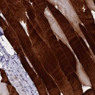 Immunohistochemistry-Paraffin: Troponin T Type 3 (fast skeletal) Antibody [NBP1-92534]