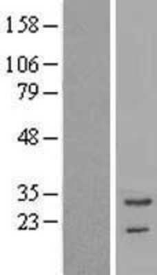 Western Blot: Troponin T Type 3 (fast skeletal) Overexpression Lysate [NBP2-10901]