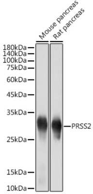Western Blot: Trypsin 2/PRSS2 Antibody (3D9O7) [NBP3-15733]