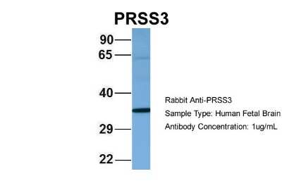 Western Blot: Trypsin 3/PRSS3 Antibody [NBP1-57036]