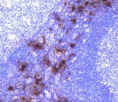 Immunohistochemistry-Paraffin: Tryptase alpha/beta 1 Antibody (SC68-07) [NBP2-67608]