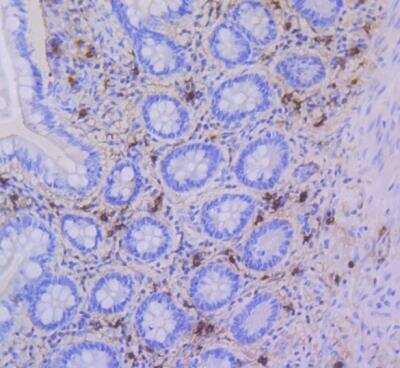 Immunohistochemistry-Paraffin: Tryptase alpha/beta 1 Antibody (SC68-07) [NBP2-67608]