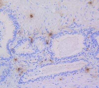 Immunohistochemistry-Paraffin: Tryptase alpha/beta 1 Antibody (SC68-07) [NBP2-67608]