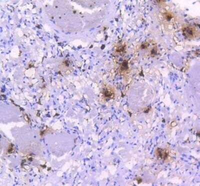 Immunohistochemistry-Paraffin: Tryptase alpha/beta 1 Antibody (SC68-07) [NBP2-67608]