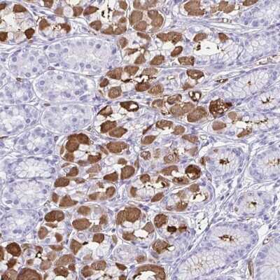 Immunohistochemistry: Tryptase gamma-1/TPSG1 Antibody [NBP2-37977]