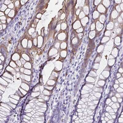 Immunohistochemistry-Paraffin: Tryptase gamma-1/TPSG1 Antibody [NBP2-37977]