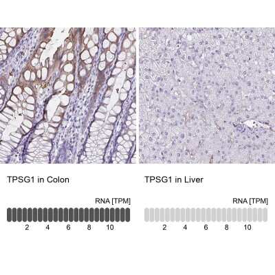 Immunohistochemistry-Paraffin: Tryptase gamma-1/TPSG1 Antibody [NBP2-37977]