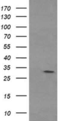 Western Blot: Tryptase gamma-1/TPSG1 Antibody (OTI1E11)Azide and BSA Free [NBP2-74649]