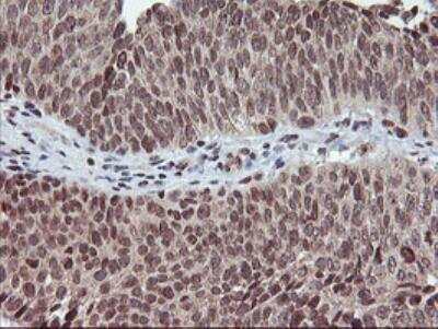 Immunohistochemistry-Paraffin: Tryptase gamma-1/TPSG1 Antibody (OTI1G1) - Azide and BSA Free [NBP2-74652]