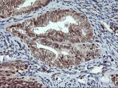 Immunohistochemistry-Paraffin: Tryptase gamma-1/TPSG1 Antibody (OTI1G1) [NBP2-01679]