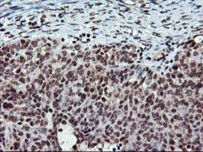 Immunohistochemistry-Paraffin: Tryptase gamma-1/TPSG1 Antibody (OTI1G1) [NBP2-01679]