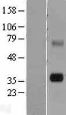 Western Blot: Tryptase gamma-1/TPSG1 Overexpression Lysate [NBL1-17231]