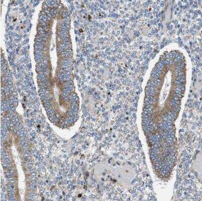 Immunohistochemistry-Paraffin: Tryptophan Hydroxylase 1/TPH-1 Antibody [NBP1-86922]