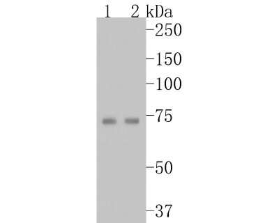 Western Blot: Tryptophan Hydroxylase 1/TPH-1 Antibody (SC53-07) [NBP2-67580]