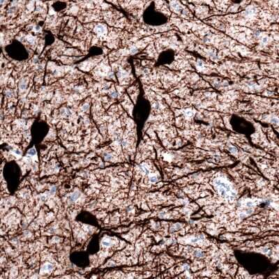 Immunohistochemistry-Paraffin: Tryptophan hydroxylase 2 Antibody (CL2990) [NBP2-46646]