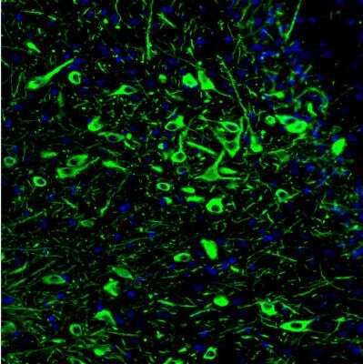 Immunohistochemistry: Tryptophan hydroxylase 2 Antibody (CL2990) [NBP2-46646]