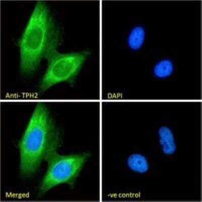 Immunocytochemistry/ Immunofluorescence: Tryptophan hydroxylase 2 Antibody [NB100-2447]
