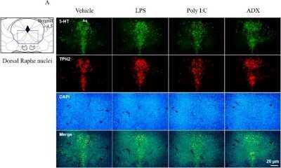 Immunocytochemistry/ Immunofluorescence: Tryptophan hydroxylase 2 Antibody - BSA Free [NB100-74555]