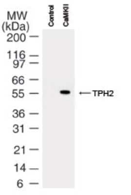 Western Blot: Tryptophan hydroxylase 2 [p Ser19] Antibody [NB100-61104]