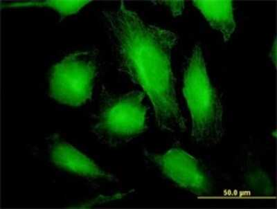 Immunocytochemistry/ Immunofluorescence: Tryptophanyl tRNA synthetase Antibody (3A12) [H00007453-M02]
