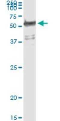 Immunoprecipitation: Tryptophanyl tRNA synthetase Antibody (3A12) [H00007453-M02]