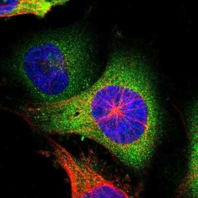 Immunocytochemistry/ Immunofluorescence: Tryptophanyl tRNA synthetase Antibody [NBP2-55159]