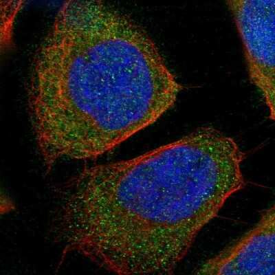 Immunocytochemistry/ Immunofluorescence: Tryptophanyl tRNA synthetase Antibody [NBP2-55377]