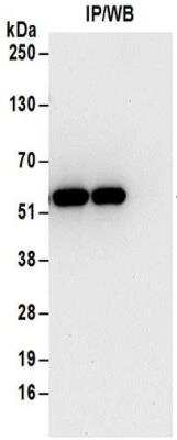 Immunoprecipitation: Tryptophanyl tRNA synthetase Antibody [NBP2-32185]