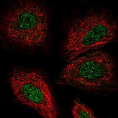 Immunocytochemistry/ Immunofluorescence: Tsukushi/TSK Antibody [NBP1-87959]