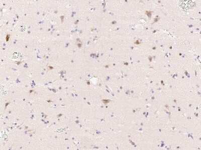 Immunohistochemistry-Paraffin: Tubby Antibody [NBP2-99110]