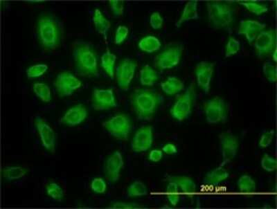 Immunocytochemistry/ Immunofluorescence: Tubulin Beta 2C Antibody (1G3) [H00010383-M02]