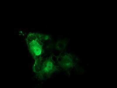 Immunocytochemistry/ Immunofluorescence: Tubulin Beta 4 Antibody (OTI3F1) [NBP2-00812]