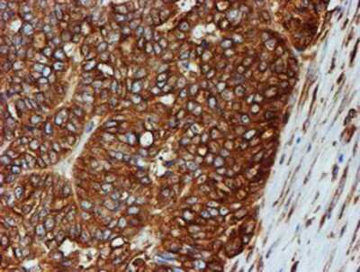 Immunohistochemistry-Paraffin: Tubulin Beta 4 Antibody (OTI3F1) [NBP2-00812]