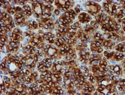 Immunohistochemistry-Paraffin: Tubulin Beta 4 Antibody (OTI3F1) [NBP2-00812]