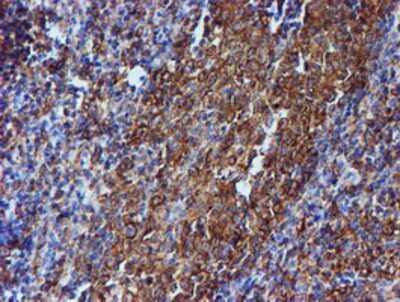 Immunohistochemistry-Paraffin: Tubulin Beta 4 Antibody (OTI3F1) [NBP2-00812]