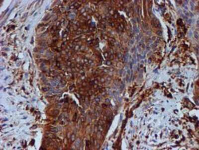 Immunohistochemistry: Tubulin Beta 4 Antibody (OTI3F1) - Azide and BSA Free [NBP2-74713]
