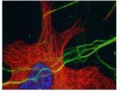 Immunohistochemistry: Delta 1 Tubulin Antibody [NB100-57397]