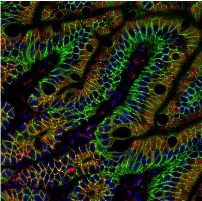 Immunohistochemistry-Paraffin: Tubulin alpha-1B Antibody (114) [NBP2-43837]
