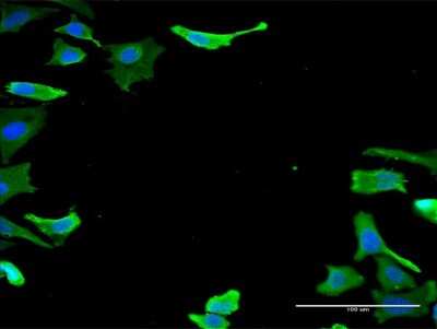 Immunocytochemistry/ Immunofluorescence: Tubulin alpha-1B Antibody (2E8) [H00010376-M12]